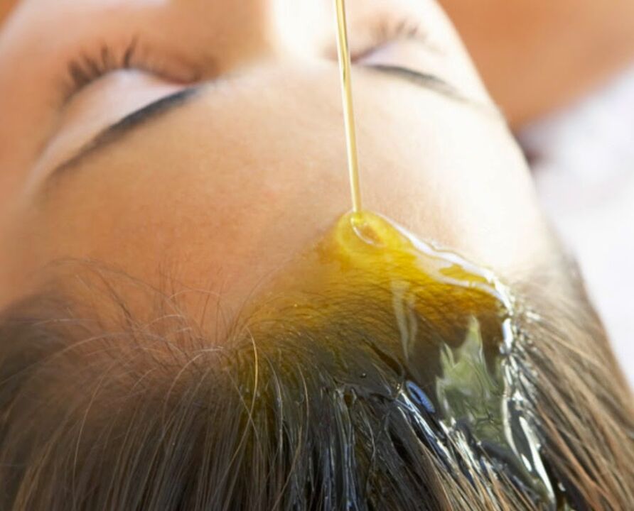 oil for psoriasis of the head