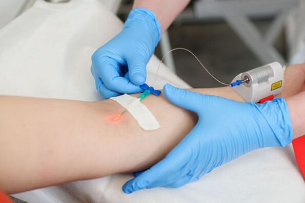 intravenous laser treatment of psoriasis of the feet