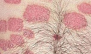 Multiple pink abdominal formations