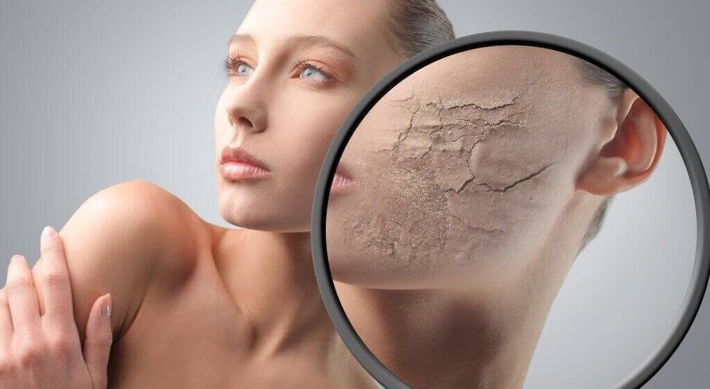 Skin destruction