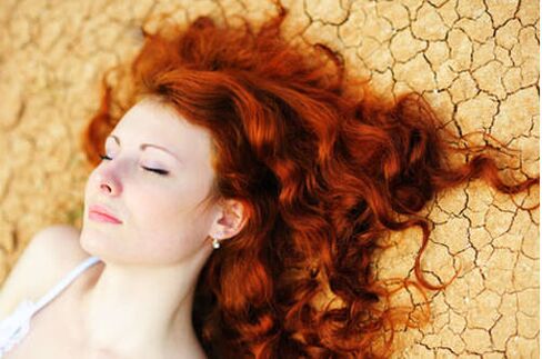 A girl with psoriasis